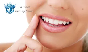 Teeth Whitening Session at La Glace Brackenfell